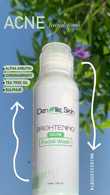 Acne Facial Wash